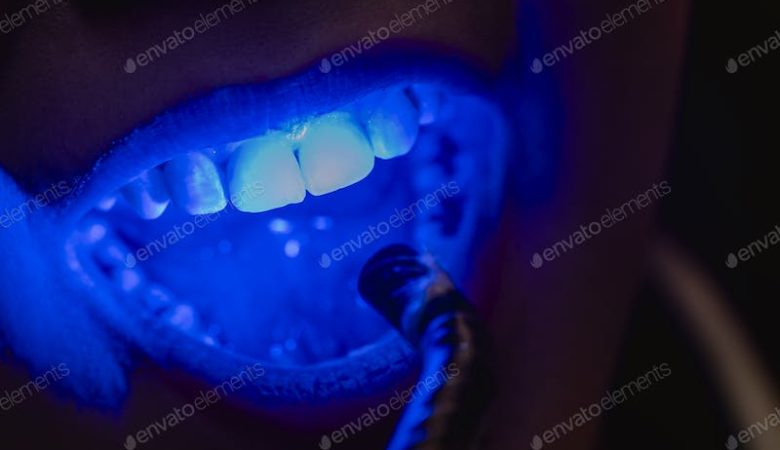 Dental lights